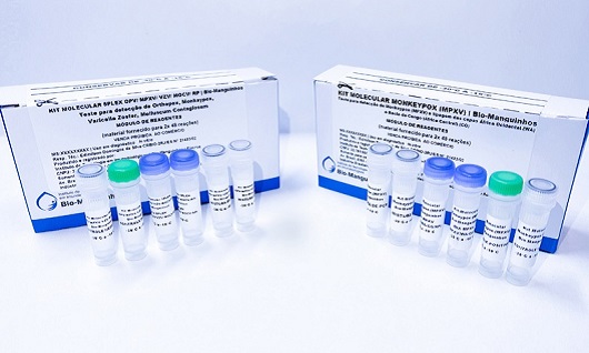 Fiocruz pede à Anvisa registro de 2 kits para diagnóstico da monkeypox: É para uso imediato nos estados